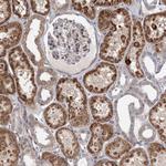 RNF111 Antibody in Immunohistochemistry (Paraffin) (IHC (P))