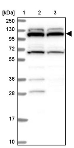 RNF111 Antibody in Western Blot (WB)