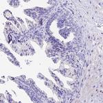 ICEBERG Antibody in Immunohistochemistry (Paraffin) (IHC (P))