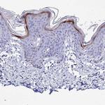 ICEBERG Antibody in Immunohistochemistry (Paraffin) (IHC (P))