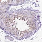 C11orf70 Antibody in Immunohistochemistry (Paraffin) (IHC (P))