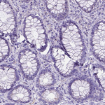 C11orf70 Antibody in Immunohistochemistry (Paraffin) (IHC (P))