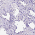 C11orf70 Antibody in Immunohistochemistry (Paraffin) (IHC (P))