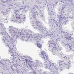 C11orf70 Antibody in Immunohistochemistry (IHC)