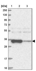 ACTR6 Antibody in Western Blot (WB)