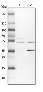 ACTR6 Antibody in Western Blot (WB)