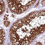 TBCEL Polyclonal Antibody