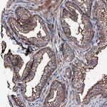 TBCEL Antibody in Immunohistochemistry (Paraffin) (IHC (P))