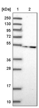TBCEL Antibody in Western Blot (WB)