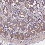 CEP295 Antibody in Immunohistochemistry (Paraffin) (IHC (P))