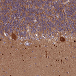 CEP295 Antibody in Immunohistochemistry (Paraffin) (IHC (P))