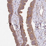 CEP295 Antibody in Immunohistochemistry (Paraffin) (IHC (P))