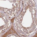 CEP295 Antibody in Immunohistochemistry (IHC)
