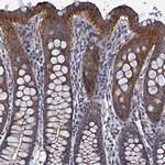 CEP295 Antibody in Immunohistochemistry (IHC)