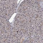 PRPF40B Antibody in Immunohistochemistry (IHC)