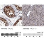 PRPF40B Antibody