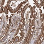 PLEKHA7 Antibody in Immunohistochemistry (Paraffin) (IHC (P))