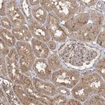 PLEKHA7 Antibody in Immunohistochemistry (Paraffin) (IHC (P))