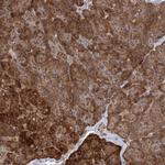 PLEKHA7 Antibody in Immunohistochemistry (Paraffin) (IHC (P))