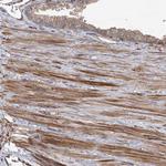 PLEKHA7 Antibody in Immunohistochemistry (Paraffin) (IHC (P))