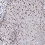 VGLL4 Polyclonal Antibody