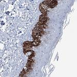 CXorf56 Polyclonal Antibody