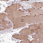 CUTC Antibody in Immunohistochemistry (Paraffin) (IHC (P))