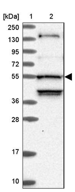 STK38L Antibody in Western Blot (WB)