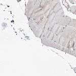 CDC42SE2 Antibody in Immunohistochemistry (IHC)