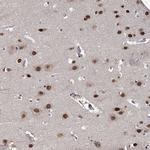 C12orf10 Antibody in Immunohistochemistry (Paraffin) (IHC (P))