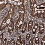 C12orf10 Antibody in Immunohistochemistry (Paraffin) (IHC (P))