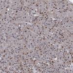 C12orf10 Antibody in Immunohistochemistry (Paraffin) (IHC (P))