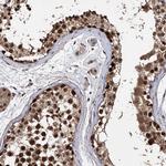 C12orf10 Antibody in Immunohistochemistry (Paraffin) (IHC (P))