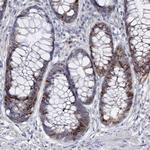 FAM111B Antibody in Immunohistochemistry (Paraffin) (IHC (P))