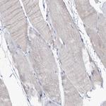 FAM111B Antibody in Immunohistochemistry (Paraffin) (IHC (P))