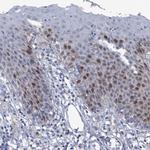 FAM111B Antibody in Immunohistochemistry (Paraffin) (IHC (P))