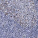 FAM111B Antibody in Immunohistochemistry (IHC)