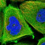 TCHP Polyclonal Antibody