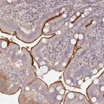 TCHP Antibody in Immunohistochemistry (Paraffin) (IHC (P))