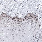 SPATS2 Polyclonal Antibody