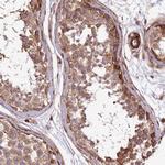 SPATS2 Antibody in Immunohistochemistry (Paraffin) (IHC (P))