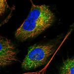 METTL7B Polyclonal Antibody