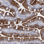 METTL7B Antibody in Immunohistochemistry (Paraffin) (IHC (P))
