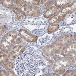 METTL7B Antibody in Immunohistochemistry (Paraffin) (IHC (P))