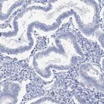 METTL7B Antibody in Immunohistochemistry (IHC)