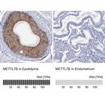 METTL7B Antibody