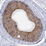 METTL7B Antibody in Immunohistochemistry (IHC)