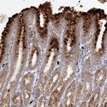 SLC41A2 Polyclonal Antibody