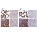BIN2 Polyclonal Antibody