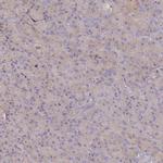 BIN2 Antibody in Immunohistochemistry (IHC)